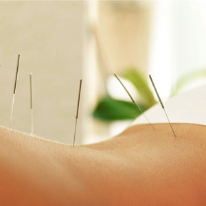 acupuncture for women's health